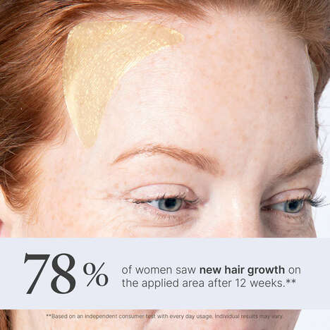 Thickening Hair Patches