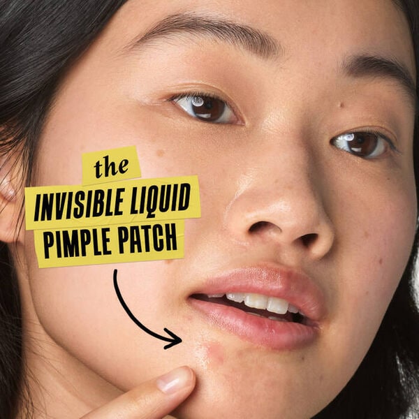 Invisible Acne Spot Treatments