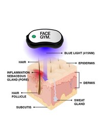 Hands-Free Acne Treatments Image 4