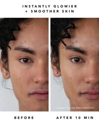 Sensitive Skin Exfoliating Serums Image 3