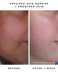 Sensitive Skin Exfoliating Serums Image 4