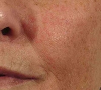 Three-Step Skincare Treatments Image 3