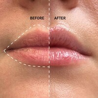 Glossy Plumping Balms Image 2