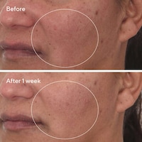 Barrier Repair Serums Image 2