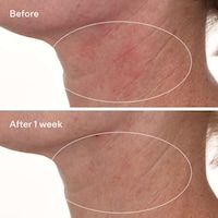 Barrier Repair Serums Image 3