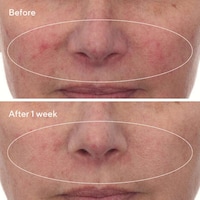 Barrier Repair Serums Image 4