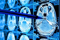 AI Cancer Detection Tools Image 1