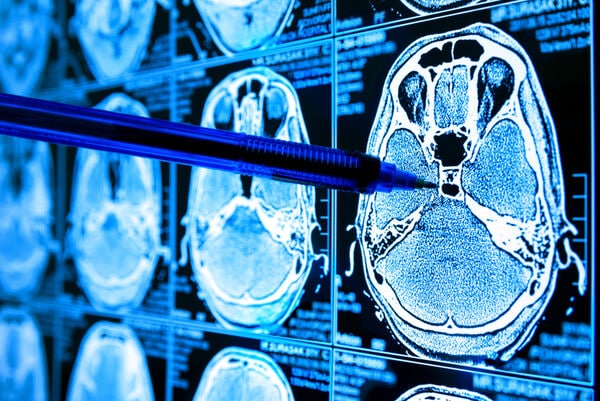 AI Cancer Detection Tools