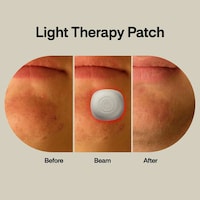 Targeted Light Therapy Patches Image 3