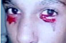 Viral Vampire Tears