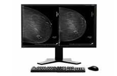 Breast Cancer AI Suites