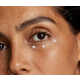 Prescription-Strength Eye Treatments Image 2