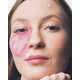 Biomimetic Pimple Patches Image 3
