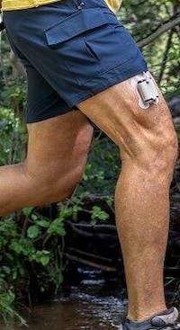 Automated Insulin Delivery Wearables Image 2