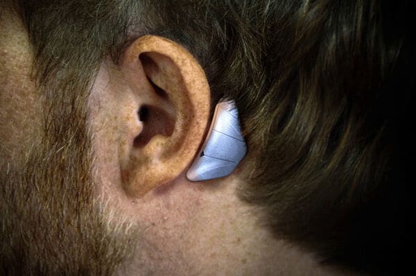 Bone Conduction Hearing Aids