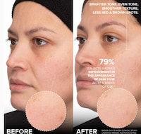 Triple-Threat Skincare Solutions Image 2