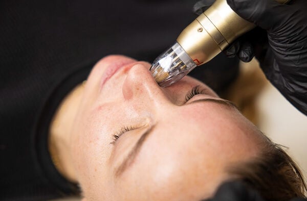 Revolutionary RF Microneedling Systems