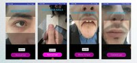Photo-Based Vitamin Deficiency Apps Image 1