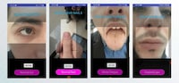 Photo-Based Vitamin Deficiency Apps