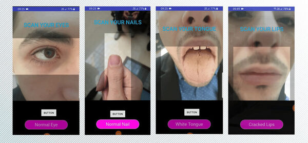 Photo-Based Vitamin Deficiency Apps