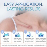 Ultra-Breathable Scar Treatments Image 3