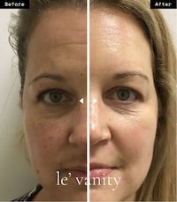 Bio-Collagen Anti-Aging Facemasks Image 1