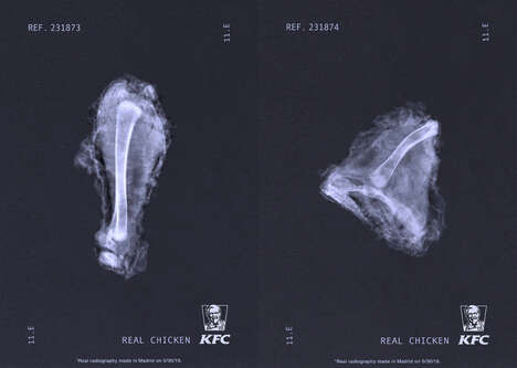 QSR X-Ray Campaigns