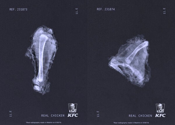 QSR X-Ray Campaigns