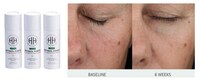 Retinol-Powered Smoothing Serums