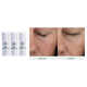 Retinol-Powered Smoothing Serums Image 1