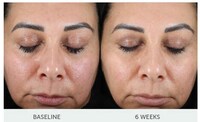 Retinol-Powered Smoothing Serums Image 2