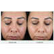 Retinol-Powered Smoothing Serums Image 2