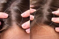 Hair-Strengthening Scalp Massagers Image 3