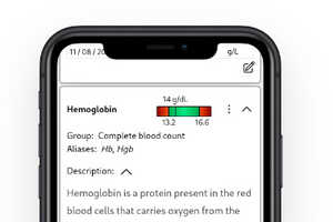 Centralized Lab Test Management: Biolytics Analyzes Lab Test Results in ...