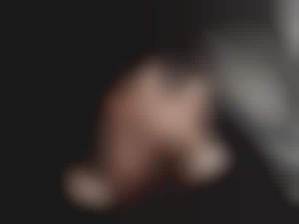Black Eye Fashiontography