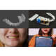 Smart Health-Monitoring Mouthpieces Image 1