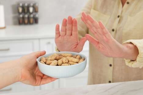 Peanut Allergen Aptamers