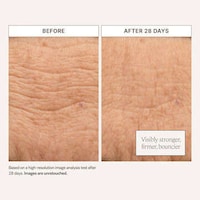 Non-Comedogenic Moisturizers Image 2