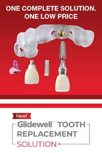 Tooth Replacement Solutions