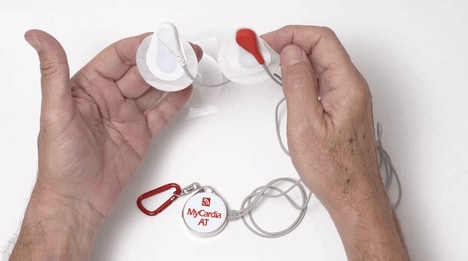Next-Generation Cardiac Event Monitors