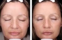 Groundbreaking Skincare Protocols Image 1