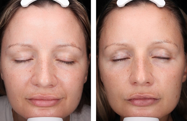 Groundbreaking Skincare Protocols