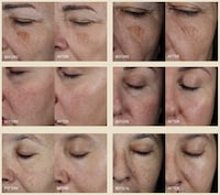 Concentrated Skincare Serums Image 4