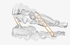 Expanded Orthodontic Systems