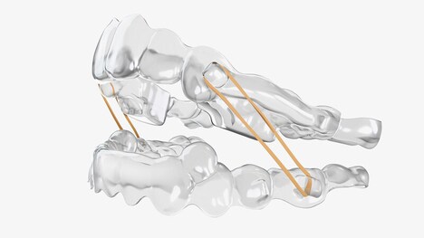 Expanded Orthodontic Systems