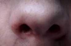 Talking Nostril PSAs