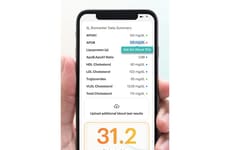 AI-Powered Lab Test Analyzers