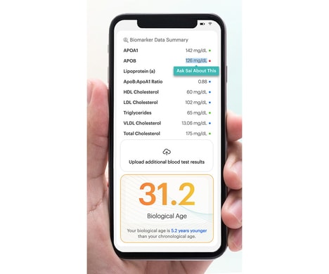 AI-Powered Lab Test Analyzers