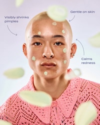 Sulfur Spot Treatments Image 2