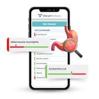 Revamped Gut Microbiome Tests Image 1